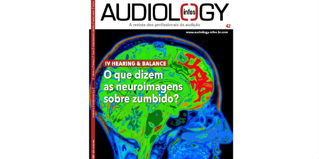 Audiology Infos Brasil 42: escáner cerebral y tinnitus