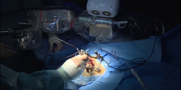 Primera cirugía en Europa con un implante coclear invisible, sin parte externa
