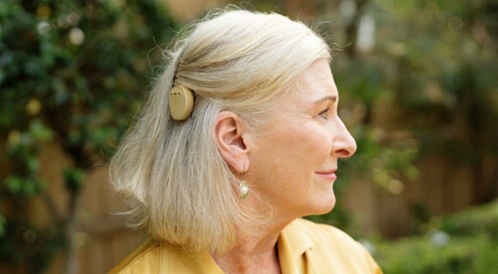 implante coclear,pérdida auditiva,GAES,Amplifon