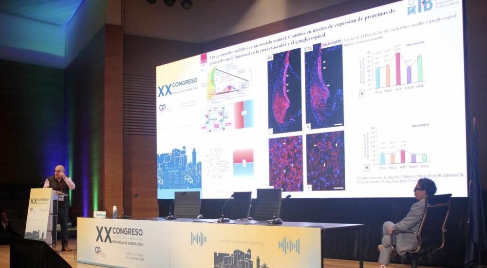 Alzheimer,presbiacusia,audición,investigación
